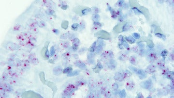 Células intestinales de una persona sana