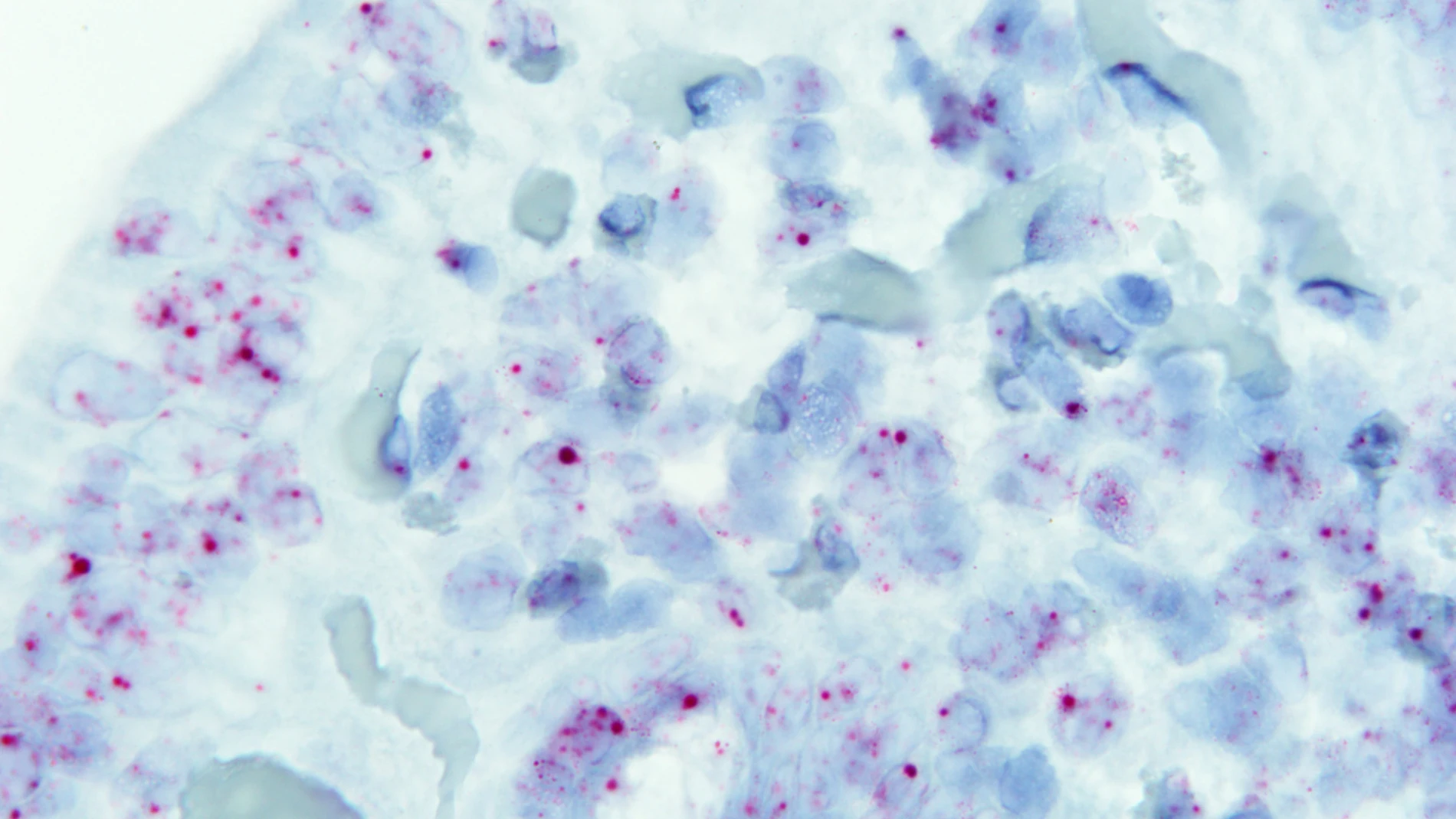 Células intestinales de una persona sana Células intestinales de una persona sana