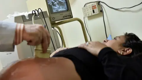 Una mujer embarazada realizándose una ecografía Una mujer embarazada realizándose una ecografía