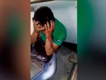 Imagen del joven agredido en el metro de Ciudad de México. Imagen del joven agredido en el metro de Ciudad de México.