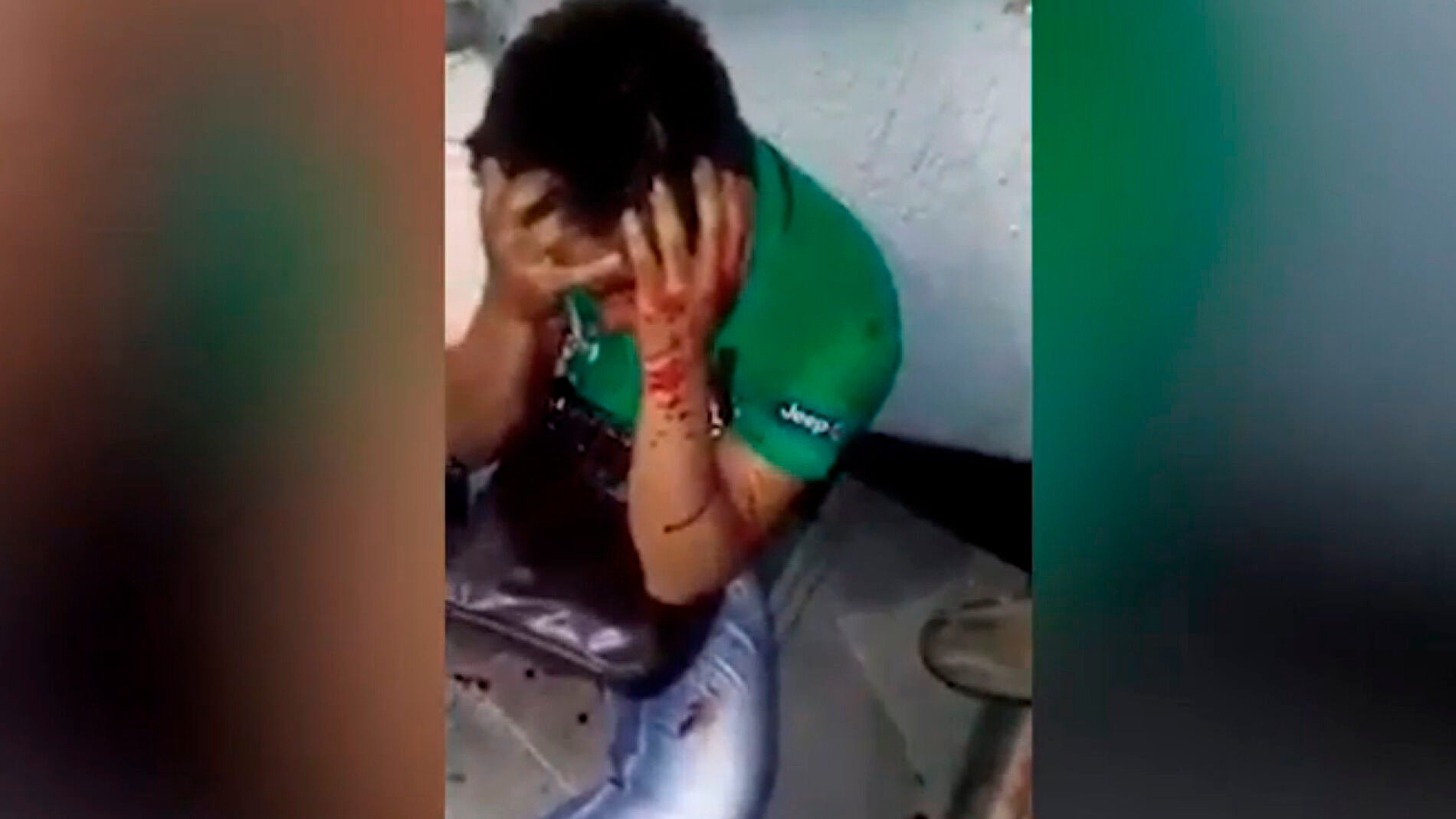 Imagen del joven agredido en el metro de Ciudad de M&eacute;xico.