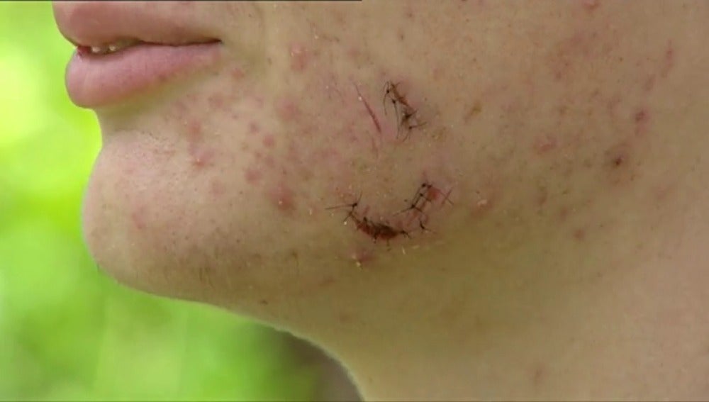Frame 28.397221 de: Un chico de 16 años recibe una paliza por tratar de impedir una agresión machista