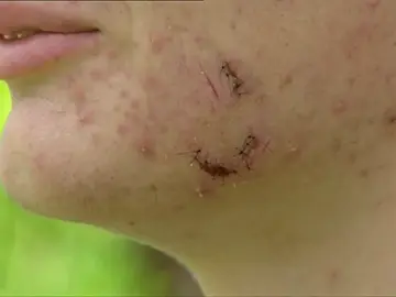 Frame 28.397221 de: Un chico de 16 años recibe una paliza por tratar de impedir una agresión machista Frame 28.397221 de: Un chico de 16 años recibe una paliza por tratar de impedir una agresión machista