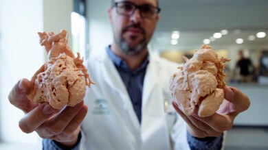 Recrean corazones con impresoras 3D a tamaño real para poder estudiar todos los detalles antes de las operaciones