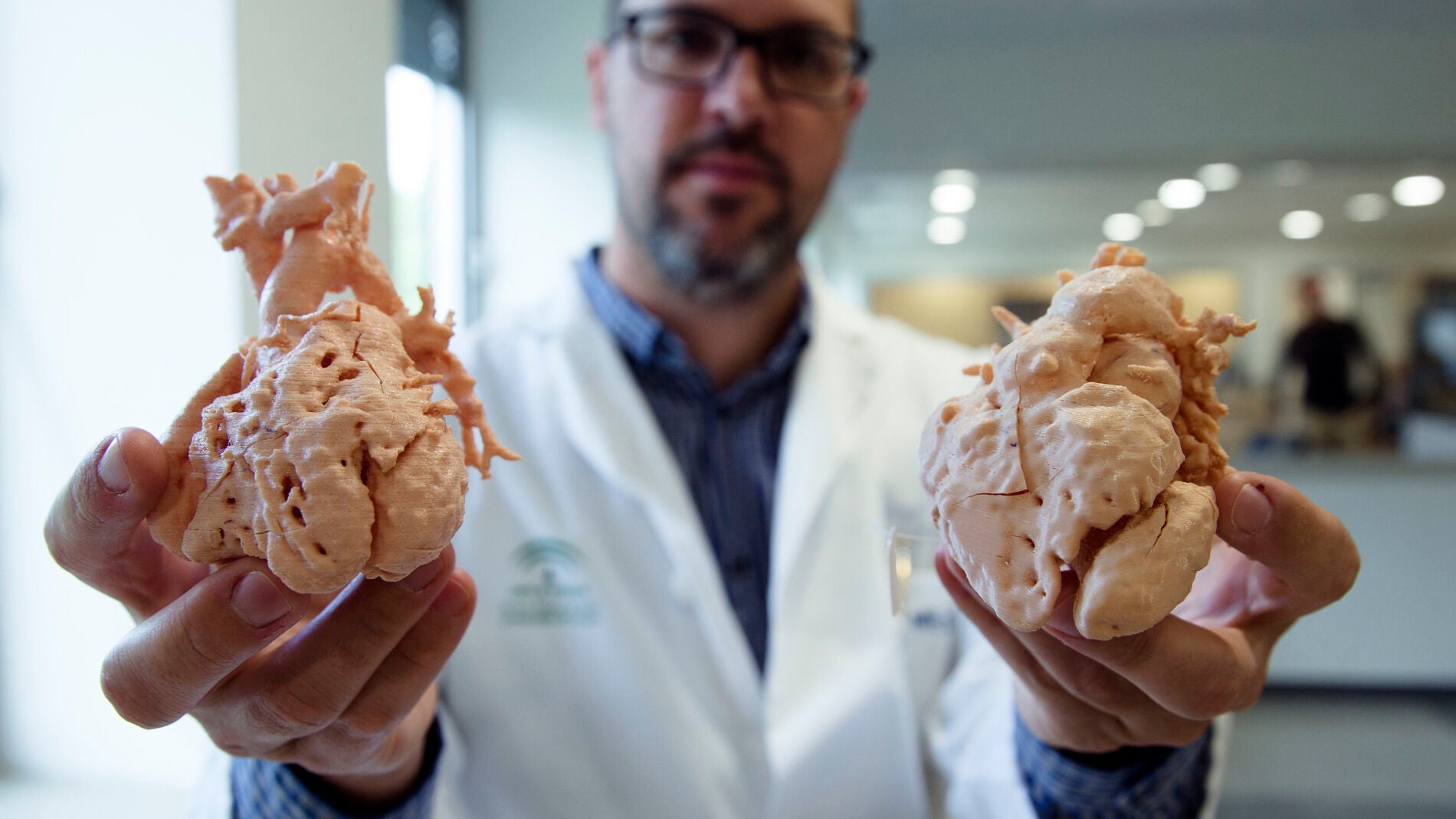 Corazones impresos a tama&ntilde;o real en 3D para planificar la intervenci&oacute;n en ni&ntilde;os