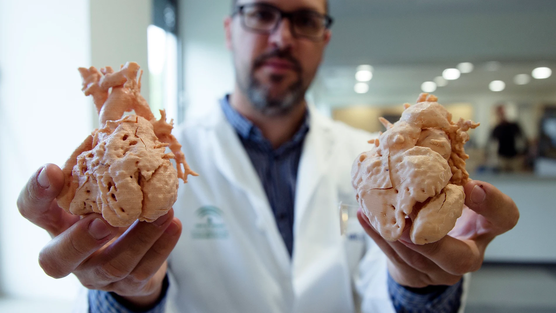 Corazones impresos a tamaño real en 3D para planificar la intervención en niños Corazones impresos a tamaño real en 3D para planificar la intervención en niños