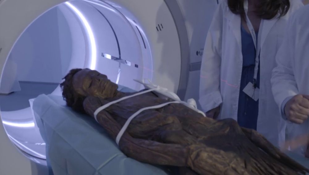 Frame 21.423921 de: Analizan con técnicas de radiología cuatro momias del Museo Arqueológico de Madrid