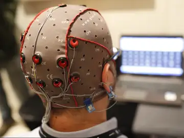 Estimulación eléctrica cerebral con electrodos Estimulación eléctrica cerebral con electrodos