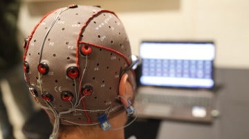 Estimulación eléctrica cerebral con electrodos