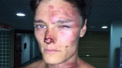 Vigilantes de un hotel de Magaluf dan una paliza a una pareja de turistas británicos