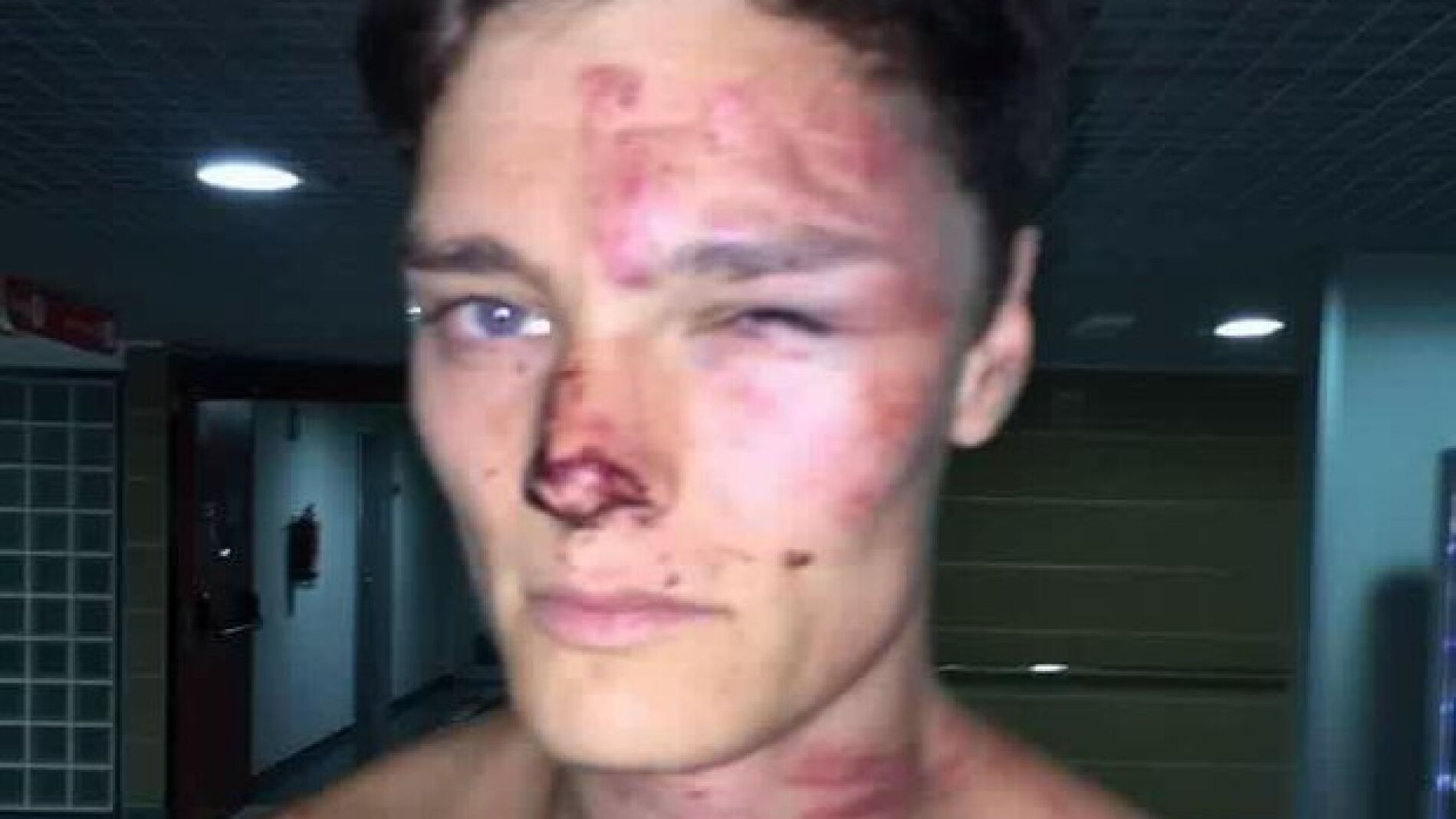 El DJ brit&aacute;nico Alex Henderson tras ser agredido en Magaluf