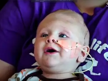 El pequeño se encuentra en buen estado de salud tras las intervenciones. El pequeño se encuentra en buen estado de salud tras las intervenciones.
