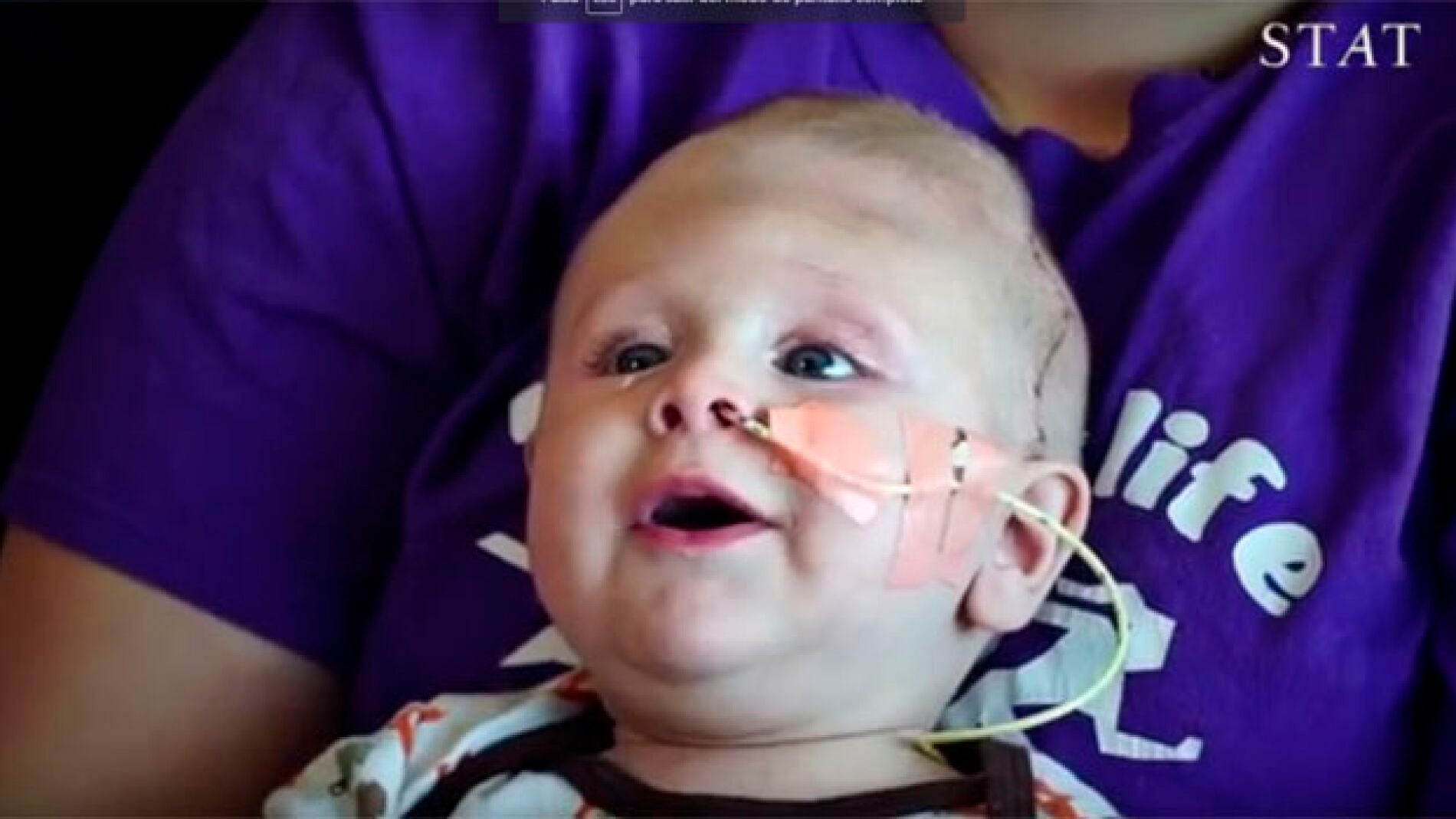 El peque&ntilde;o se encuentra en buen estado de salud tras las intervenciones.