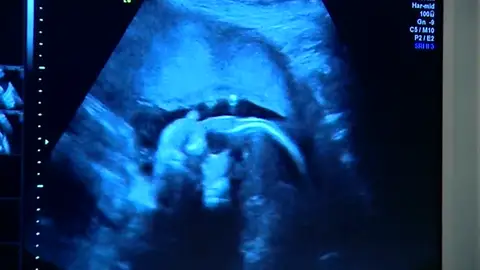 Frame 47.566308 de: Cataluña se plantea prohibir adopciones de países del Este por “alcoholismo fetal” Frame 47.566308 de: Cataluña se plantea prohibir adopciones de países del Este por “alcoholismo fetal”