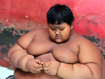 A sus 10 años, Arya Permana pesaba 200 kilos.