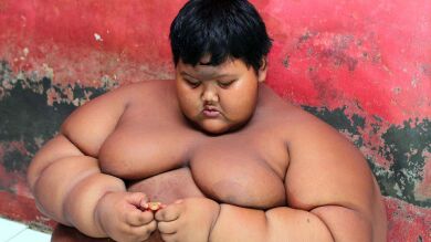 Un indonesio de 10 años es el niño más gordo del mundo con 192 kilos