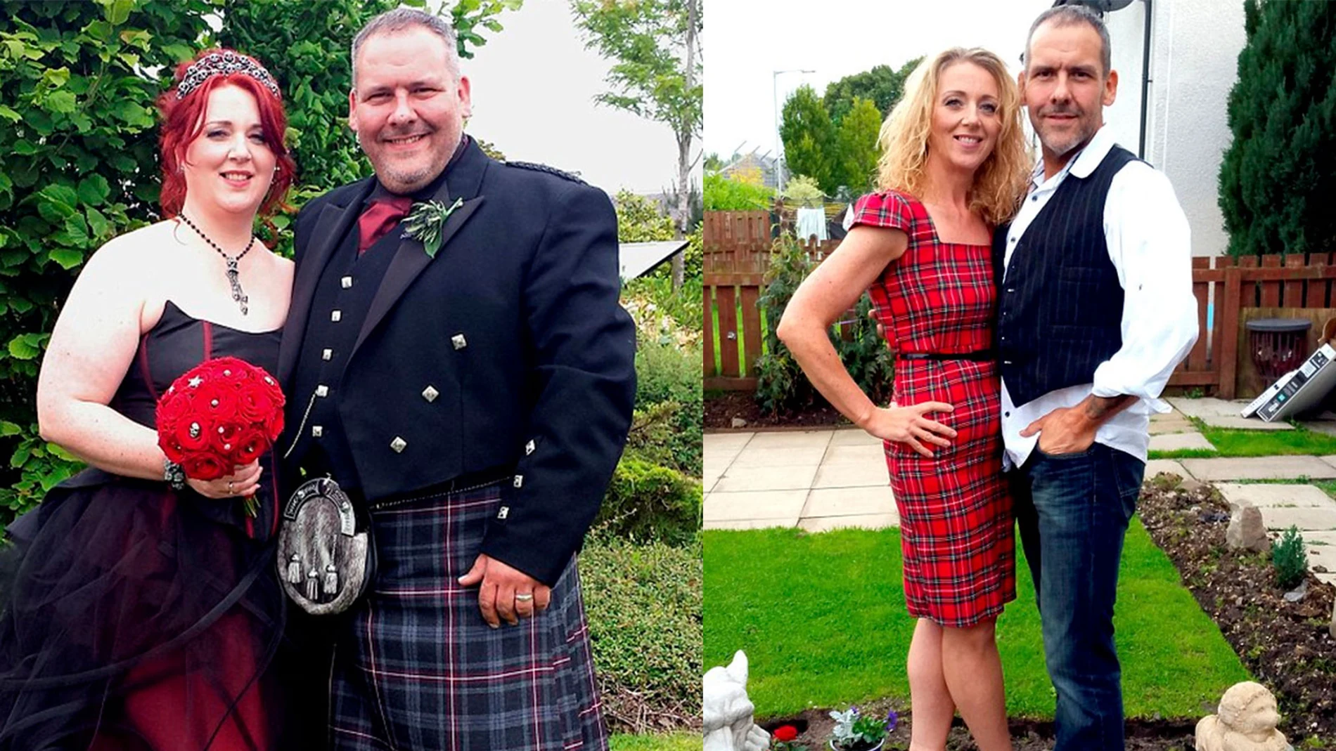 El antes y el después de su obesidad El antes y el después de su obesidad