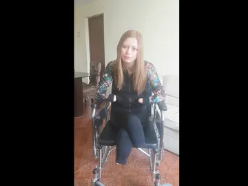 Joven peruana amputada pies y manos por negligencia médica Joven peruana amputada pies y manos por negligencia médica