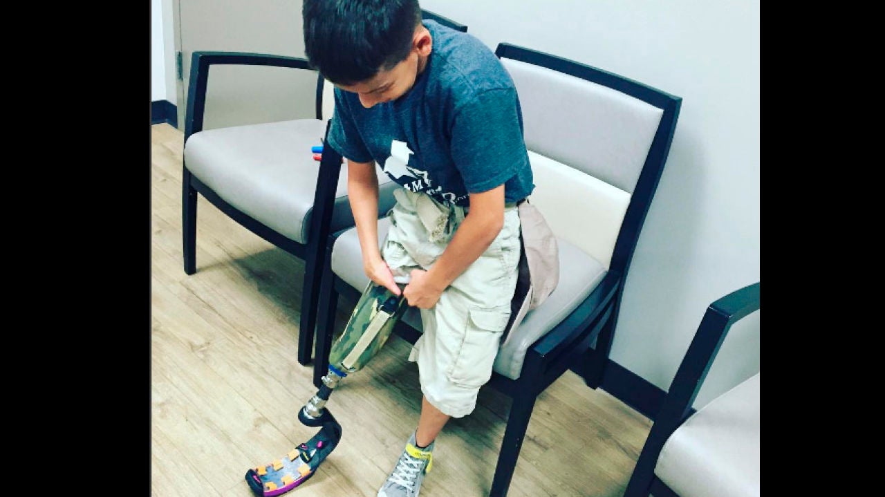 Un niño sin pierna lucha por cumplir su sueño de ser soldado