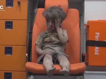 Omran, la cara de la guerra de Siria Omran, la cara de la guerra de Siria