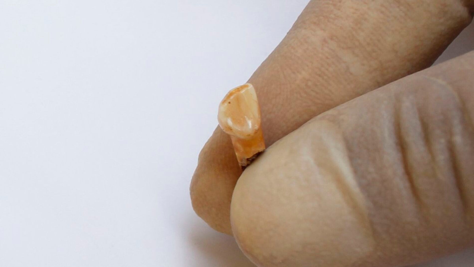 Diente de un ni&ntilde;o neandertal que vivi&oacute; en la Cova de les Teixoneres