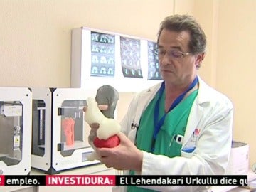 Frame 31.573474 de: Un hospital de Madrid utiliza las impresoras 3D para planificar las cirugías 
