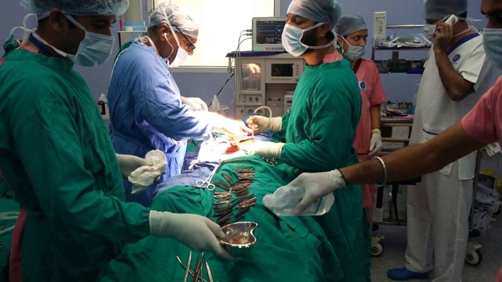 Sacan 40 cuchillos del estómago de un hombre que tenía 