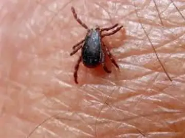 Garrapata que produce la fiebre hemorrágica Crimea-Congo Garrapata que produce la fiebre hemorrágica Crimea-Congo
