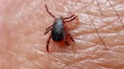 Garrapata que produce la fiebre hemorrágica Crimea-Congo Garrapata que produce la fiebre hemorrágica Crimea-Congo