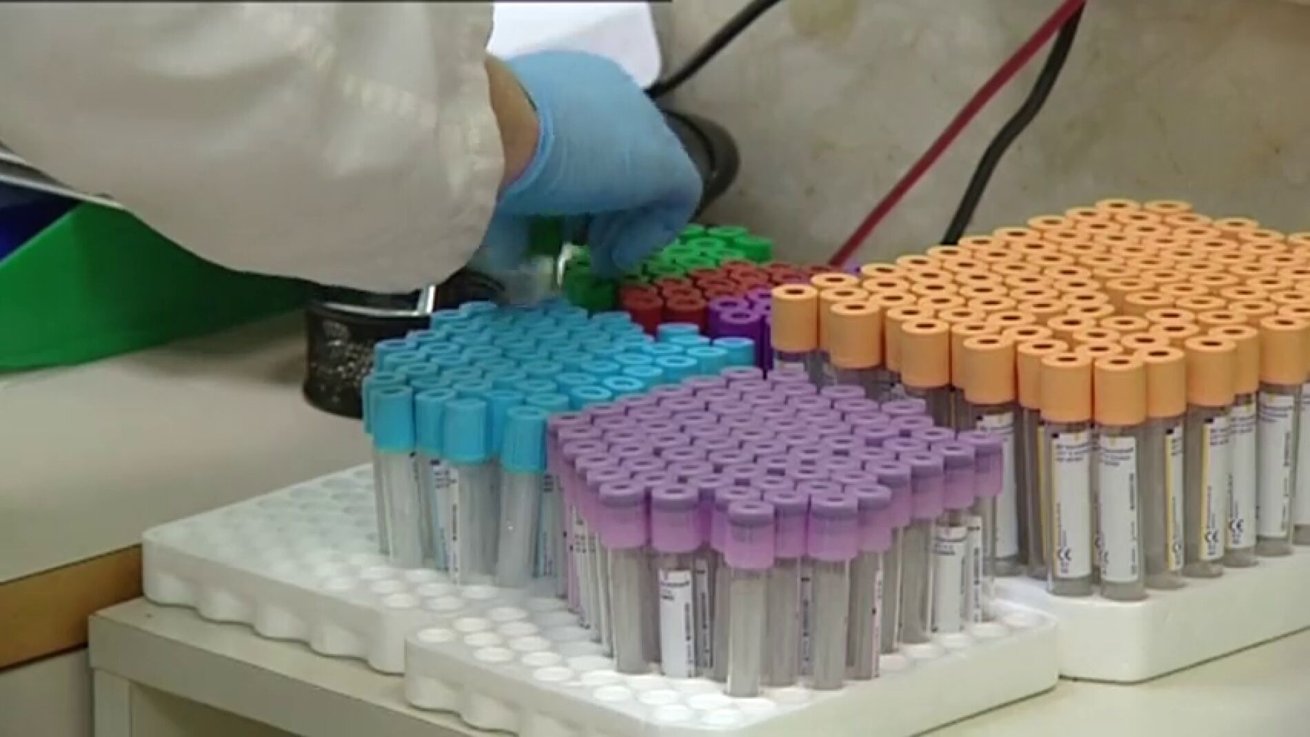 Frame 32.069501 de: Todo lo que debes saber sobre la fiebre hemorr&aacute;gica, el virus que ha llegado a Espa&ntilde;a