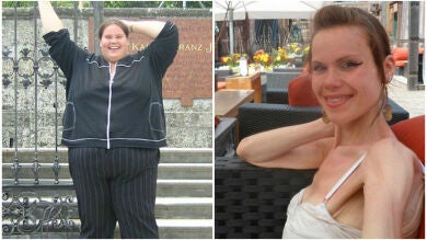 Una mujer pasa de la obesidad mórbida a la anorexia por su obsesión con el peso