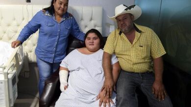Operan con éxito en México a la adolescente más obesa del mundo 