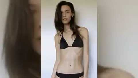 Frame 1.592917 de: Modelo australiana se niega a adelgazar para poder ser contratada Frame 1.592917 de: Modelo australiana se niega a adelgazar para poder ser contratada