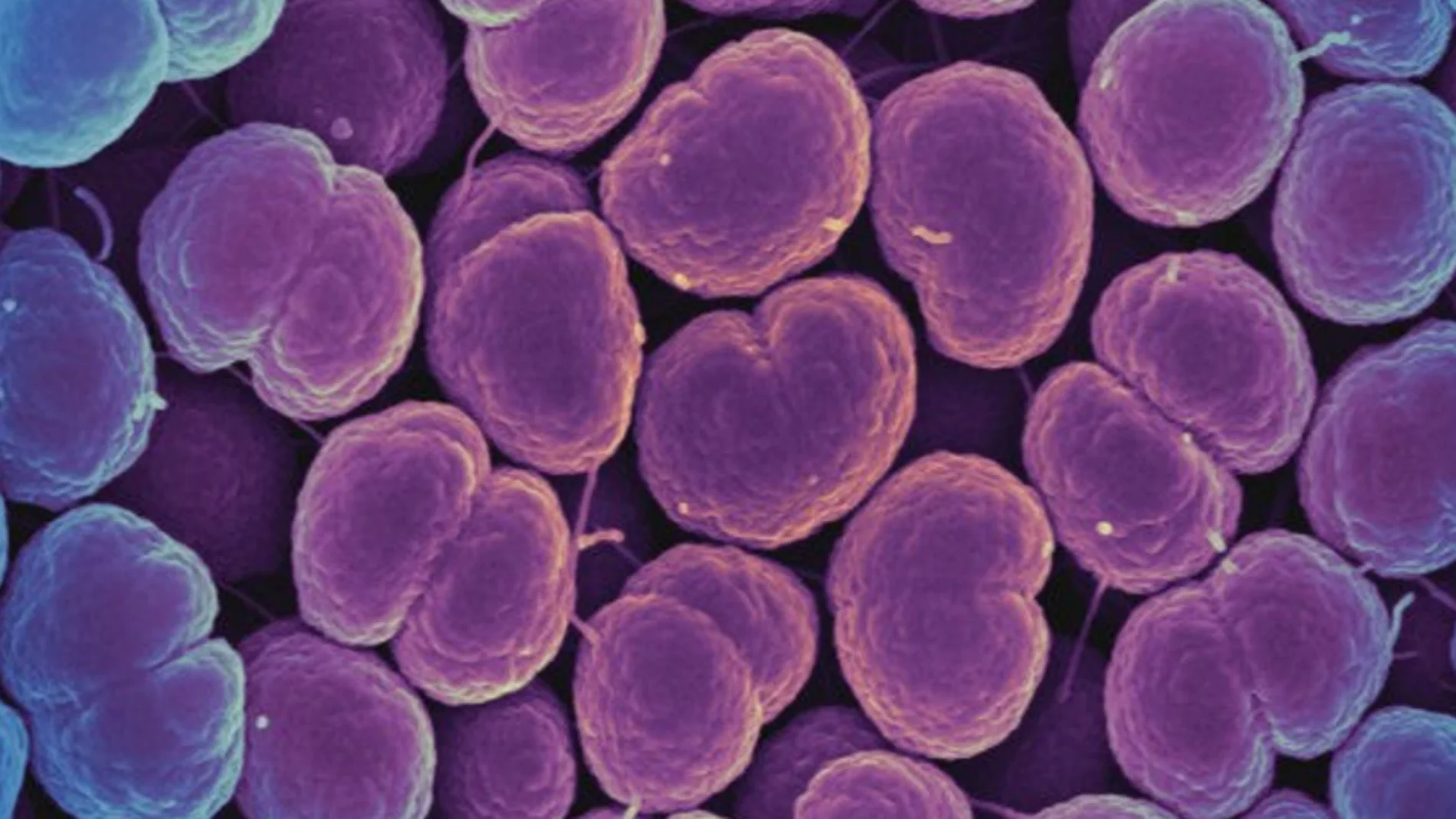 Neisseria gonorrhoeae, la bacteria que provoca la gonorreaNeisseria gonorrhoeae, la bacteria que provoca la gonorrea Neisseria gonorrhoeae, la bacteria que provoca la gonorreaNeisseria gonorrhoeae, la bacteria que provoca la gonorrea