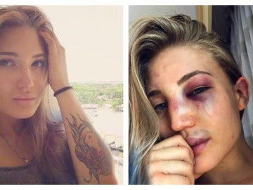 Anastasia Yankova, muestra como quedo su rostro tras un combate de MMA