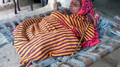 La dolorosa vida de Shanti Devi, una anciana de la India que mide 60 centímetros por una enfermedad rara