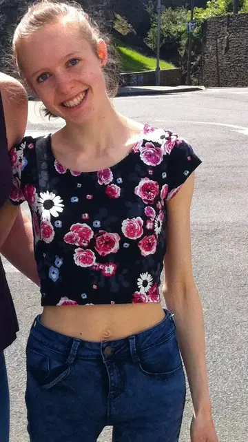 Lorna llegó a pesar 31 kilos Lorna llegó a pesar 31 kilos