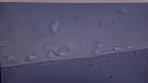 Frame 38.437892 de: Sanidad advierte del riesgo de comprar semen a trav&eacute;s de internet