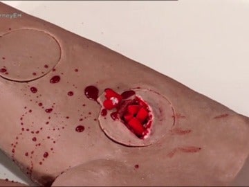 Frame 117.169829 de: Descubre las esponjas salvavidas, capaces de cortar hemorragias producidas por heridas de bala