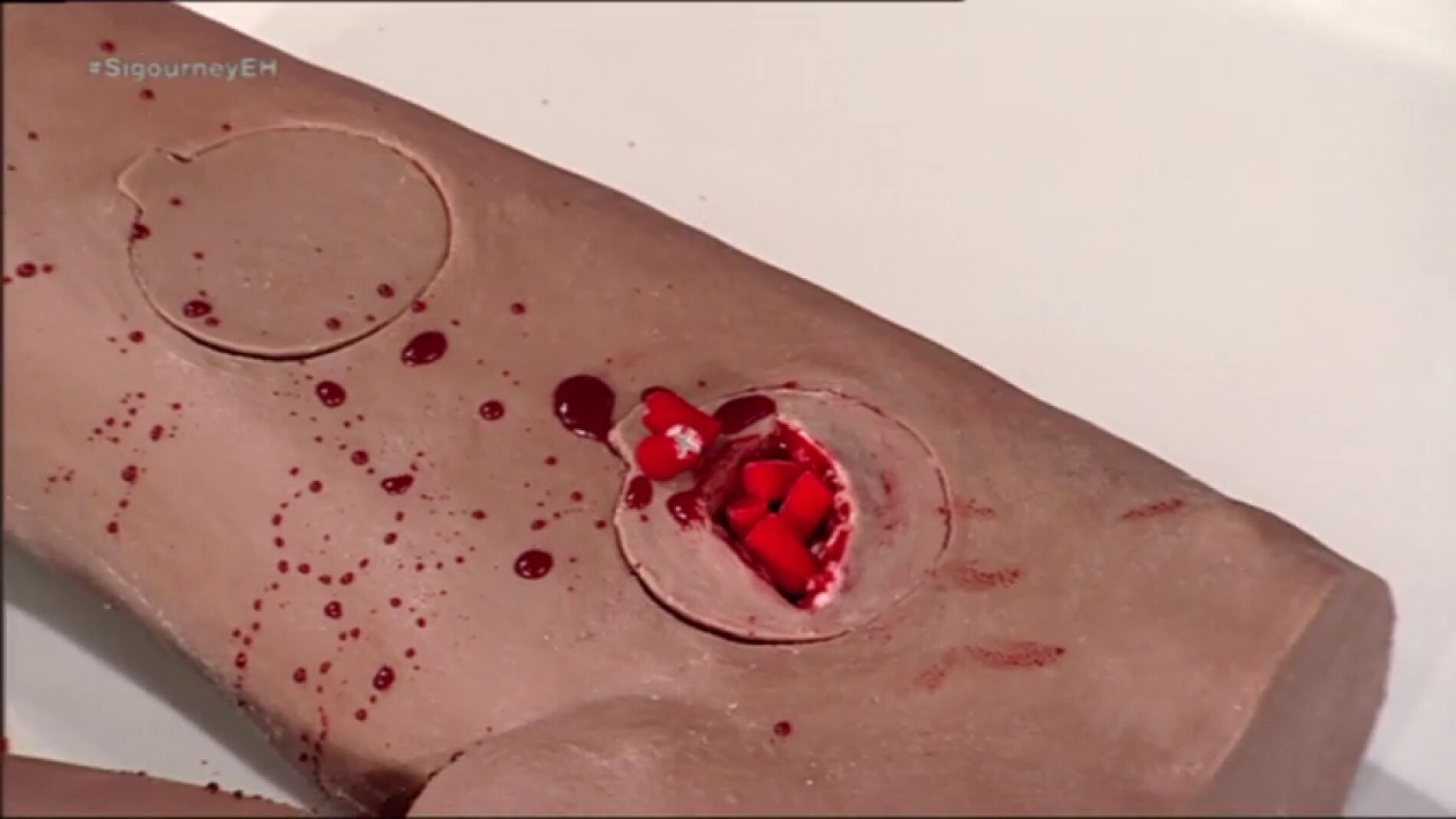 Frame 117.169829 de: Descubre las esponjas salvavidas, capaces de cortar hemorragias producidas por heridas de bala