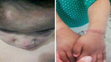 Unos padres argentinos, detenidos por atar, golpear y quemar con cigarros a sus hijos de 1, 3 y 4 años