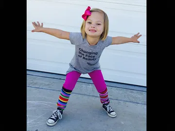 Sofía, niña con Síndrome de Down Sofía, niña con Síndrome de Down