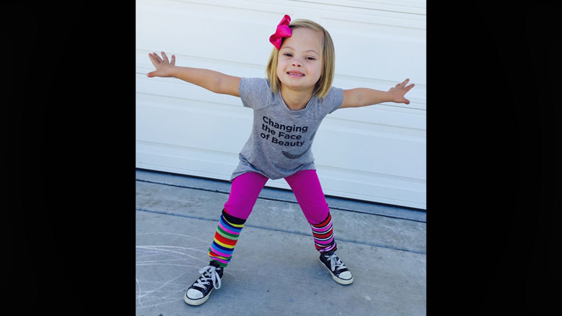 Sof&iacute;a, ni&ntilde;a con S&iacute;ndrome de Down