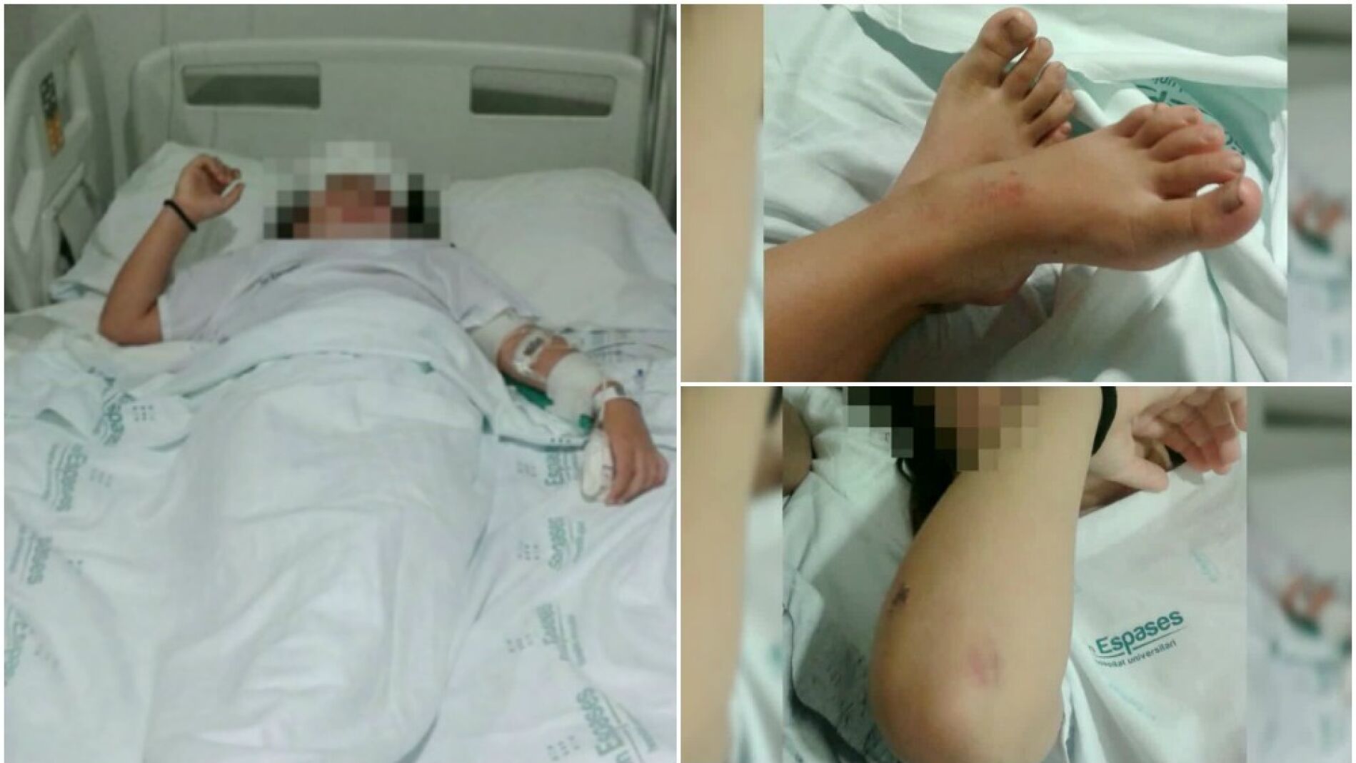 Im&aacute;genes de la ni&ntilde;a agredida en Palma