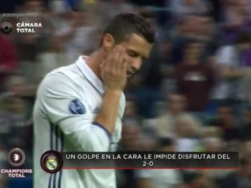 Cristiano Ronaldo se queja de un golpe en la cara tras el 2-0