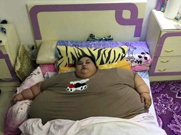 La mujer más gorda del mundo