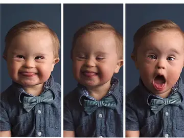 Asher en la campaña 'Cambiando la cara de la belleza' Asher en la campaña 'Cambiando la cara de la belleza'