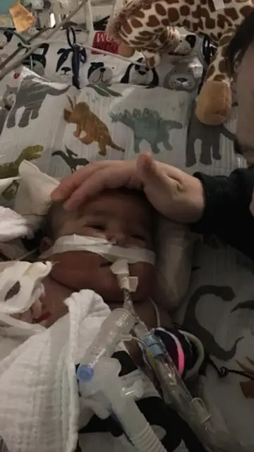 Henry, el hermanito de Nora enfermo Henry, el hermanito de Nora enfermo