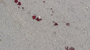 Manchas de sangre en el asfalto