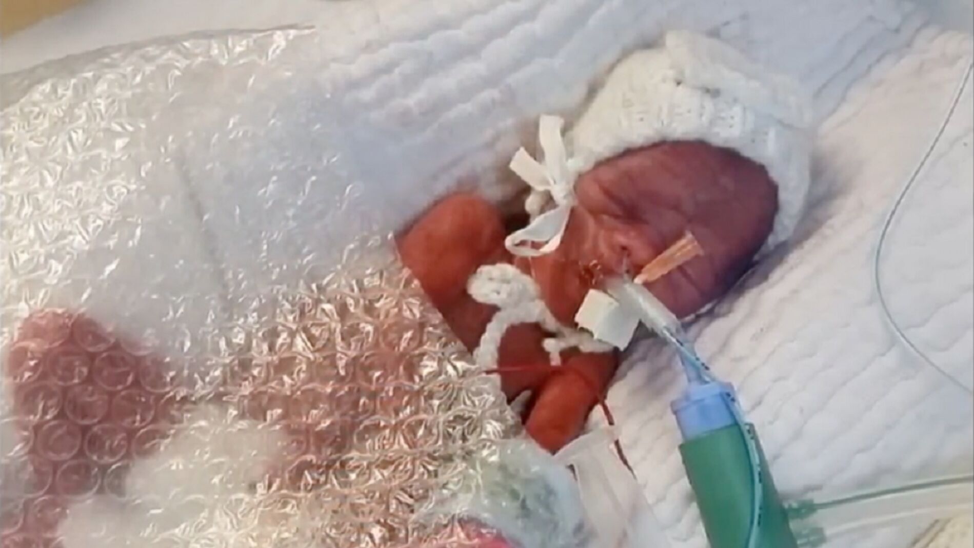 Beb&eacute; arropado con pl&aacute;stico de burbujas